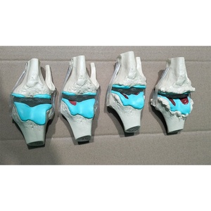 Material Didáctico Médico: Comparación de Patrones Normales y Patológicos para la Comunicación Médico-Paciente, Anatomía de la Articulación del Rodilla Humana - Product Image 3