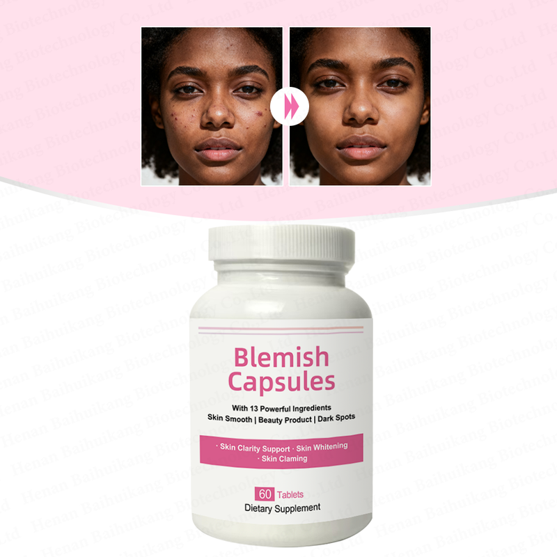 Herbal Blemish Supplements Support Skin Smoothing