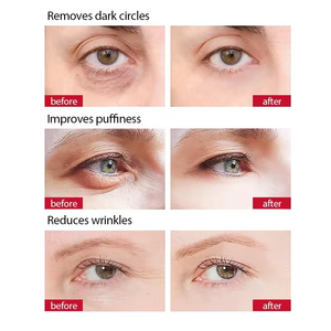 Di alta qualità coreano Anti-invecchiamento <span class=keywords><strong>crema</strong></span> per gli <span class=keywords><strong>occhi</strong></span> con retinolo vitamina C collagene acido ialuronico Dark Circle rimozione della pelle ringiovanimento - Product Image 5