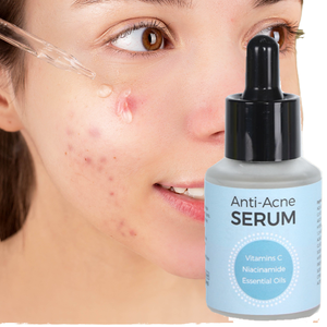 Sérum Traitant Anti-Acné et Anti-Cicatrices d'Usine : Élimine l'Acné et les Boutons, Répare le Visage - Product Image 1