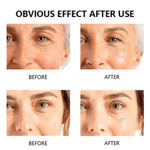 OEM / ODM LOGO personalizado de fábrica de etiqueta privada de Arbutina cara suero reduce visiblemente las manchas oscuras con ácido hialurónico - Product Image 4