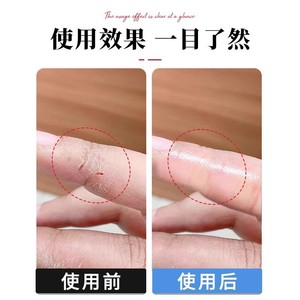 PU <b>Waterproof</b> Film Roll 5cmx1m Transparent Thin Dustproof <b>Wound</b> <b>Dressing</b> Surgical Tape - Product Image 2