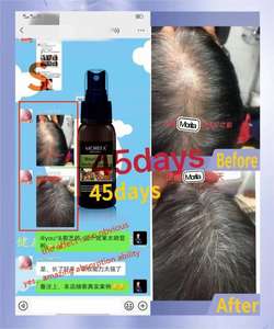 Nuevo Sérum Capilar Natural de Jengibre para el Crecimiento Rápido del Cabello, Spray para el Cuero Cabelludo, Tratamiento para la Caída del Cabello, Detiene la Pérdida de Cabello, con Biotina para Hombre y Mujer - Product Image 4