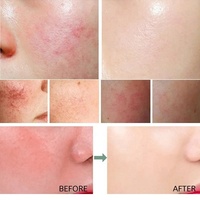 Crème Réparatrice Instantanée Anti-Rougeurs Faciales Apaisante pour Peau Sensible et Hydratante