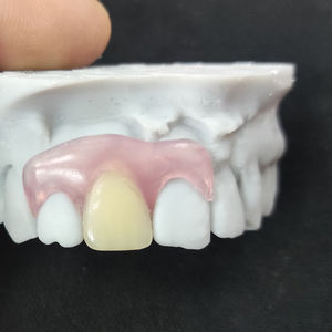Riduzione minima dei denti miglior prezzo protesi flessibile <span class=keywords><strong>Valplast</strong></span> rimovibile con falsi denti acrilici artificiali - Product Image 6