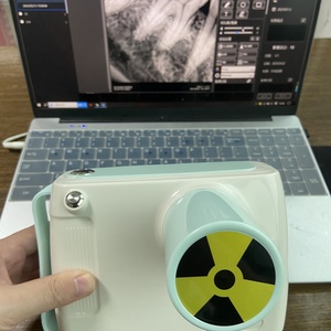 Máquina de Rayos X Portátil Eficiente, Sin Radiación y Autocalibrada, Adecuada para el Departamento de Estomatología SM-1S/10S - Product Image 3