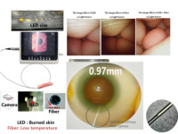Câble micro médical CDMO AWG46 de 1,05-1,05 mm, module CMOS OCHTA10, endoscope jetable, assemblage micro-optique médical ISO13485