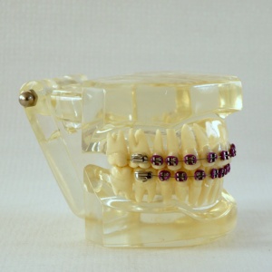 Dents dentaires orth modèles orthodontiques avec supports - Product Image 3