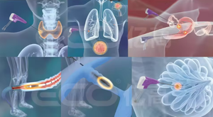 2026 आईएसओ प्रमाणित निर्माता के साथ ट्यूमर उपचार के लिए चिकित्सा माइक्रोवेव अपस्फीति प्रणाली - Product Image 6