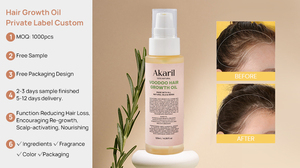 Huile de croissance capillaire Akaril Voodoo 100% naturelle à base d'extraits de plantes favorise la repousse des cheveux prévient les pellicules et les démangeaisons du cuir chevelu hydrate les cheveux - Product Image 2