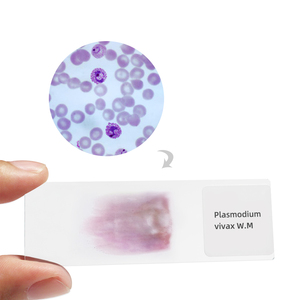 Слайды для микроскопа Plasmodium <span class=keywords><strong>Vivax</strong></span>, медицинская наука, паразитология, подготовленные слайды для микроскопа - Product Image 1