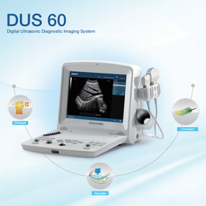 Appareil d'échographie portable <span class=keywords><strong>Edan</strong></span> <span class=keywords><strong>Dus</strong></span>-<span class=keywords><strong>60</strong></span>, échographe portable <span class=keywords><strong>Edan</strong></span> - Product Image 4