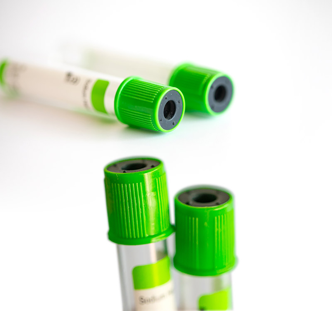 High Quality Disposable Vacuum Blood Sample Collection Tube