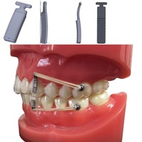 Aparelho ortodôntico de silicone, aparelho dentário, treinador de alinhamento, retentor de dentes, correção, controle de raiz, acessórios