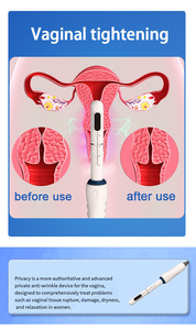 Women's Anti-Aging Vaginal Massage Tightening <strong>Machine</strong> <strong>Portable</strong> Professional Vaginal H1FU Tightener - Product Image 2