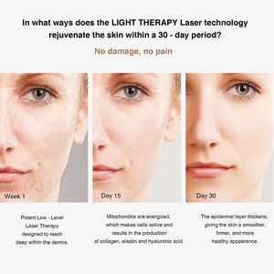 Dispositivo de belleza ocular de microcorriente 2025, masajeador de ojos, masaje de vibración, cuidado reafirmante de la piel, antienvejecimiento, elimina las arrugas, masajeador de ojos oscuros - Product Image 5