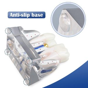 Modèle d'implant dentaire pour l'éducation des patients, modèle d'implant dentaire, de couronne et de pont 4 fois plus grand pour la présentation - Transparent - Product Image 5