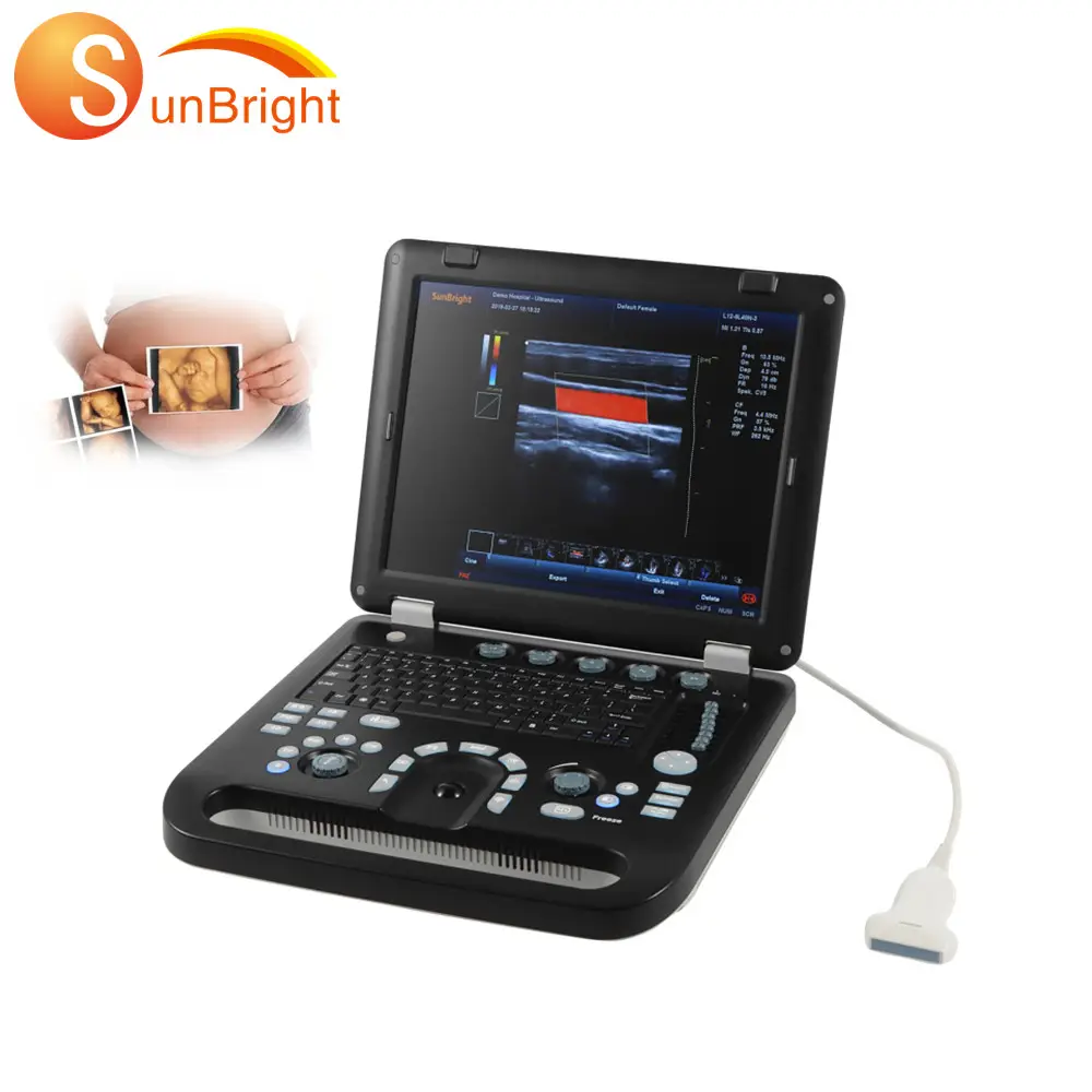 Máquina de ultrasonido 3d 4d portátil, dispositivo de ultrasonido con ecocardiaco usg, doppler a color de alta calidad