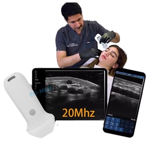 Ecógrafo Doppler Color de Alta Frecuencia Portátil para Estética Facial y Mapeo Vascular, Escáner de Ultrasonido Veterinario CU120-V2 - Product Image 1