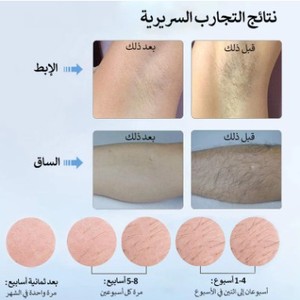 เครื่องกำจัด<span class=keywords><strong>ขน</strong></span>แบบพกพา Mlay T4 Ice Cool IPL <span class=keywords><strong>เลเซอร์</strong></span>กำจัดขน ใช้กับเครื่อง Pro Laser Fusion Epilator 36w - Product Image 5