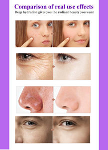 Roushun קולגן לבן פנים קרם עמוק לחות להתחדש הלבנת חלק פנים קרם - Product Image 6