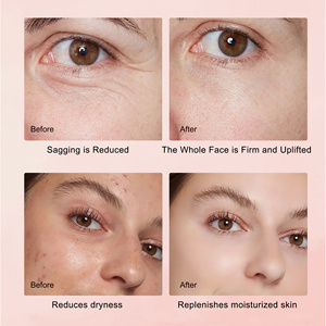 Set de Cuidado Facial Antiarrugas, Blanqueador e Hidratante Perla <span class=keywords><strong>Pura</strong></span> con <span class=keywords><strong>Vitamina</strong></span> <span class=keywords><strong>C</strong></span> y Niacinamida, OEM/ODM Lujo Coreano <span class=keywords><strong>para</strong></span> Todo Tipo de Piel - Product Image 2