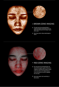 Máquina Profesional de Análisis de Piel con IA para Uso en Salón, Analizador de Humedad, Arrugas, Acné y Poros, Escáner de Piel con Análisis de 8 Pigmentos Espectrales - Product Image 6