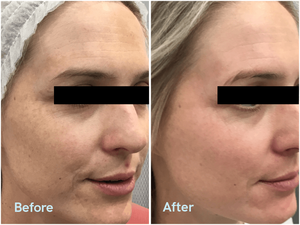 Crema Facial Blanqueadora y Quitapecas <span class=keywords><strong>Mesoestetic</strong></span> <span class=keywords><strong>Cosmelan</strong></span> de España - Product Image 3