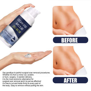 เจลซ่อมแซมผิวที่มีประสิทธิภาพ,ครีมลบแผลเป็นรอยสิวธรรมชาติสำหรับผิวกาย - Product Image 2