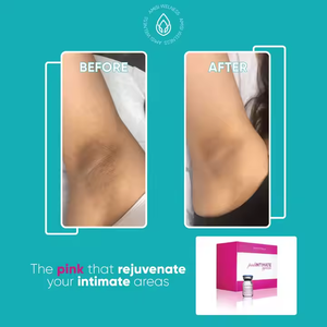 เจลบำรุงผิวจุดซ่อนเร้น โปรโมอิตาเลีย พิงค์ อินทิเมท พิงค์ อาร์เอฟ อินทิเมท แอนตี้เอจจิ้ง <span class=keywords><strong>รี</strong></span>จูวีเนйтинг ไล<span class=keywords><strong>ท</strong></span>์เ<span class=keywords><strong>ท</strong></span>นนิ่ง เจล บำรุงผิวจุดซ่อนเร้น ขายดี ปี 2026 - Product Image 3