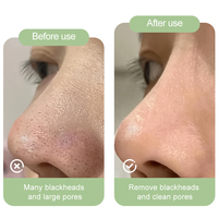 10 pièces en gros nettoyage des pores dissolvant de points noirs nez patchs masque charbon de bois nez bandes