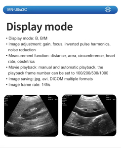 Ultra Scanner de poche sans fil Sonde à réseau linéaire convexe <span class=keywords><strong>portable</strong></span> Obstétrique Abdomen Couleur Doppler Usage vétérinaire - Product Image 5