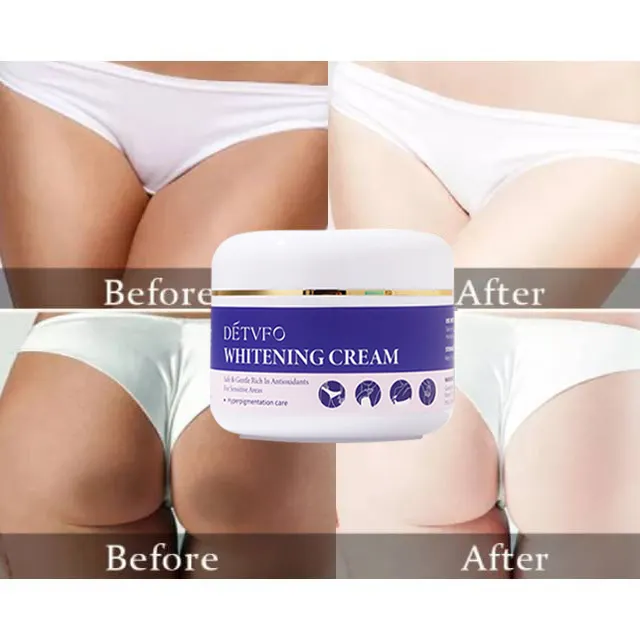 Private parts strong brightening intimate bleaching cream lightening cream skin whitening body lotion