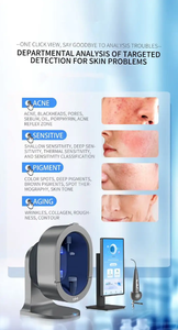 Analyseur intelligent de la peau et du cuir chevelu, appareil de diagnostic beauté avec détection microbienne et UV - Product Image 4