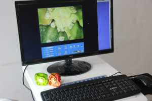 Colposcópio ginecológico de imagem digital de alta definição para exame ginecológico vulvovaginal vaginal e doença cervical - Product Image 6