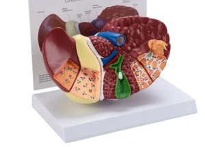 Modello didattico di anatomia distributiva delle artiere celiaca di fegato, milza, pancreas e duodeno per la scienza medica - Product Image 4