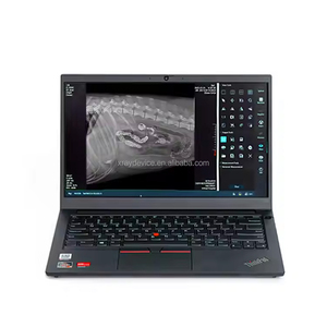 Accesorios de Rayos X Fatali, Computadora Portátil Digital para Hospital - Product Image 6