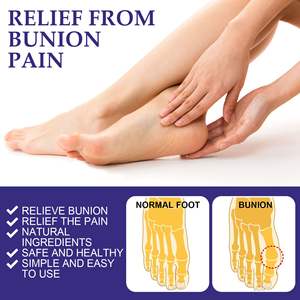 2026 Produk Terlaris Harga Pabrik Bantalan Gel Lembut untuk Metatarsal Korektor Bunion Perawatan Hallux Valgus untuk Meredakan Nyeri Jari Kaki Besar - Product Image 3