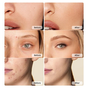 Base correctora líquida mate <span class=keywords><strong>de</strong></span> buena cobertura <span class=keywords><strong>de</strong></span> alta calidad 6ml, cubre debajo <span class=keywords><strong>de</strong></span> los ojos <span class=keywords><strong>ojeras</strong></span> y manchas - Product Image 4