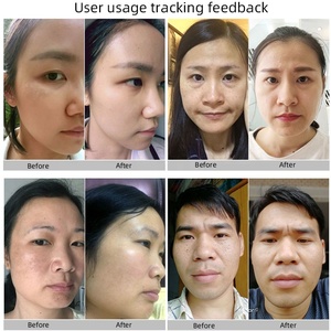 OEM Crème visage, corps, <span class=keywords><strong>aisselles</strong></span>, coudes, genoux, zones sensibles, hyperpigmentation, traitement blanchissant, élimination des taches de rousseur, taches brunes - Product Image 2