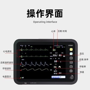 Moniteur ECG multi-canaux 12 pouces portable pour usage médical à domicile avec batterie intégrée certifié CE pour l'exportation - Product Image 3