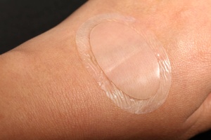 <strong>5</strong> Years Medical Skin Health Care Wound Care Dressings Sacral Scarum CMC <strong>Hydrocolloid</strong> Dressing Bordered - Product Image 4