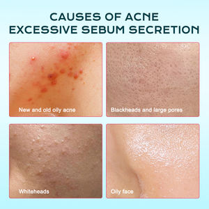 Disques de coton nettoyants pour l'acné à l'acide salicylique IREV, marque privée, 80 unités, hydratants et apaisants pour peaux acnéiques, OEM - Product Image 2