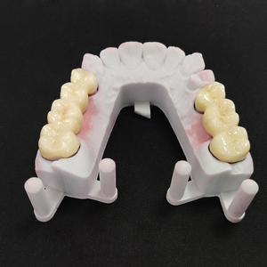 Tutti i denti di porcellana ceramica Zirconia corone impianto dentale produttore cina buon prezzo - Product Image 2