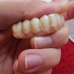 Blocs de céramique dentaires en zircone Disque de zircone Super translucidité 98mm pour système ouvert pour couronne dentaire antérieure et pont - Product Image 5