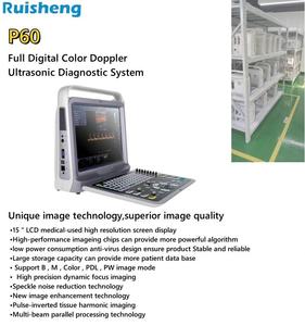 One-Stop Service Jinzhong JZ-CUP60 15-Inch Laptop 2d Volledig Digitale Ultrasone Scanner Digitale Kleur <span class=keywords><strong>Doppler</strong></span> Diagnostische Machine - Product Image 6