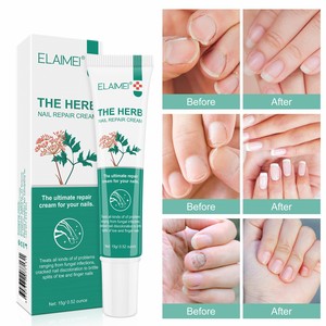 Crema Reparadora <span class=keywords><strong>de</strong></span> Uñas ELAIMEI para Infecciones por Hongos, Tratamiento para Hongos <span class=keywords><strong>en</strong></span> Uñas <span class=keywords><strong>de</strong></span> Pies y Manos, Crema Extra Fuerte - Product Image 2
