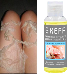 <span class=keywords><strong>Aceite</strong></span> Exfoliante Corporal al por Mayor, el Más Efectivo para Eliminar la Piel Muerta y Blanquear - Product Image 3