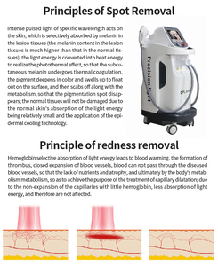 Máquina de Rejuvenecimiento de Precisión DPL+ para Eliminación de Vello, Manchas y Células Rojas, 550-650nm, Eliminación de Rojeces - Product Image 5