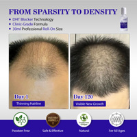 Sérum Capillaire en Roll-on pour la Repousse des Cheveux, Enrichi en Redensyl, Capixyl et Tripeptide de Cuivre-2 pour une Amélioration Visible de la Densité Capillaire